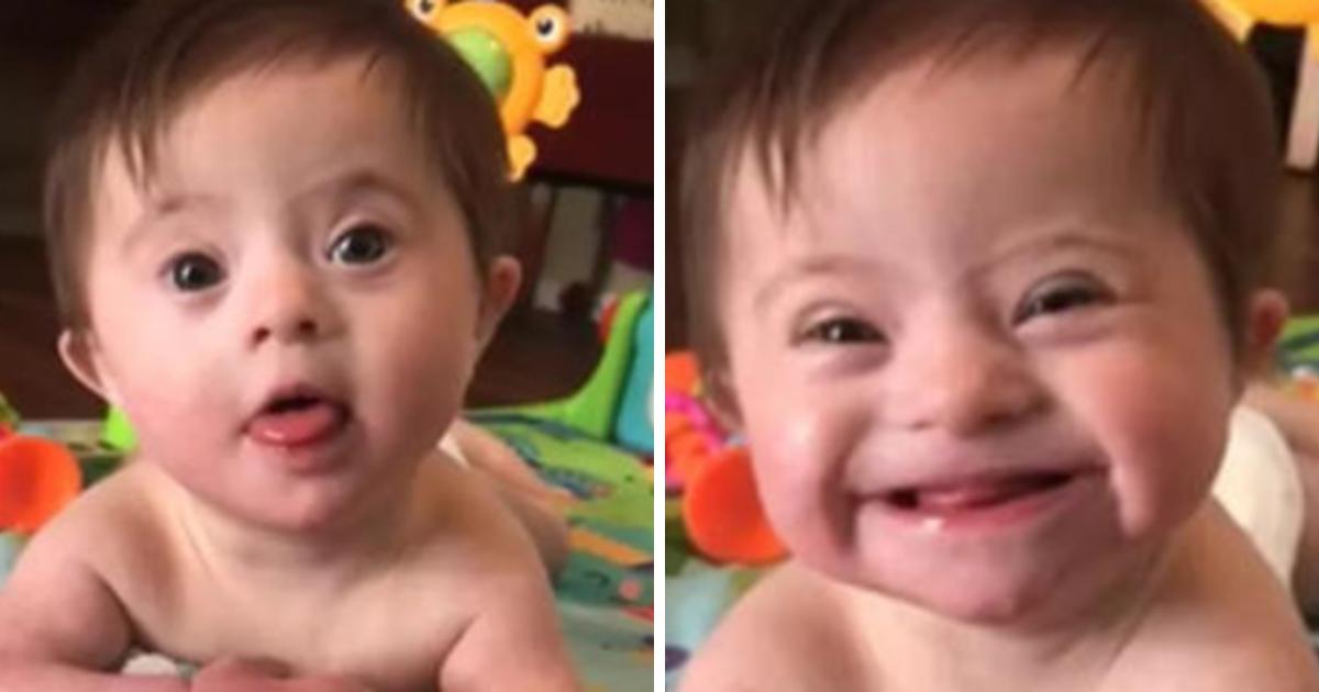 Un bébé trisomique est devenu populaire après avoir montré son «nouveau sourire» à sa mère adoptive