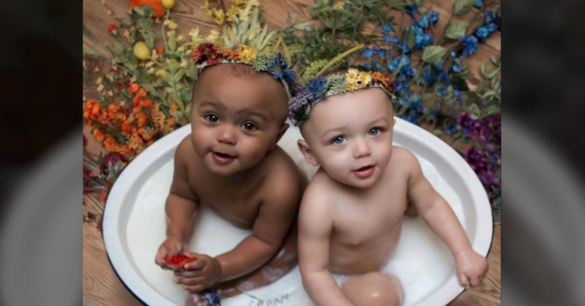 22 ans après leur naissance, les premières sœurs jumelles nées avec une couleur de peau différente sont devenues adultes