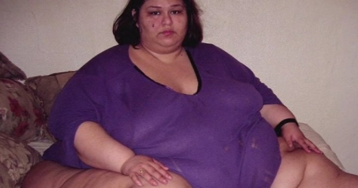 La plus grosse femme du monde a perdu 400 kg et ne pèse plus que 90 kg (Photos)